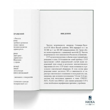 Синдром Сильвера-Рассела. Клиника, Диагностика, Лечение.