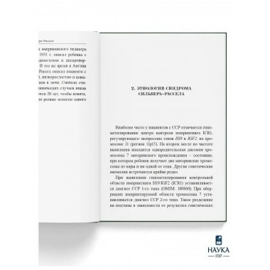 Синдром Сильвера-Рассела. Клиника, Диагностика, Лечение.