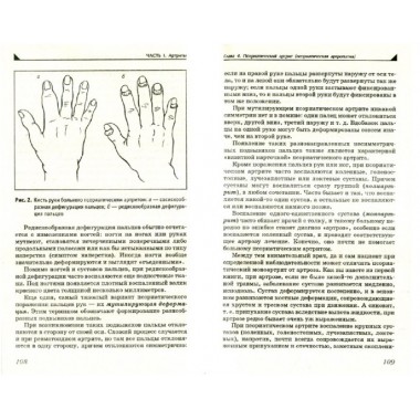 Артрит. Избавляемся от болей в суставах. Евдокименко П.В.