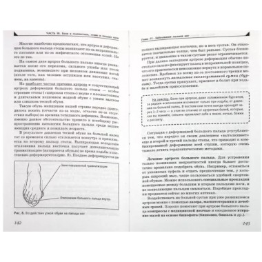 Боль в ногах. Что нужно знать о своем заболевании. Евдокименк