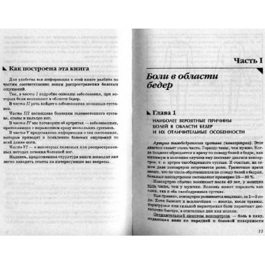 Боль в ногах. Что нужно знать о своем заболевании. Евдокименк