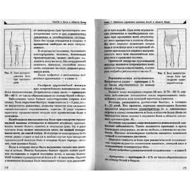 Боль в ногах. Что нужно знать о своем заболевании. Евдокименк