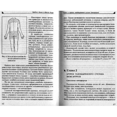 Боль в ногах. Что нужно знать о своем заболевании. Евдокименк