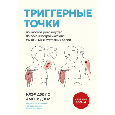 Триггерные точки.