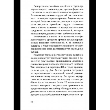 Целебная сила пиявки.