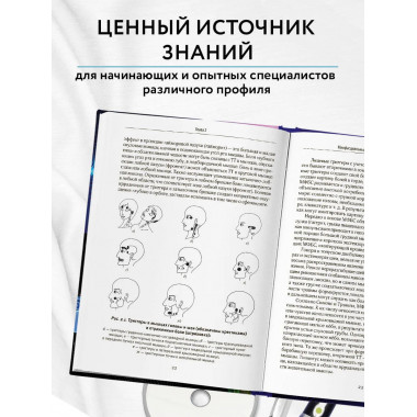 Диагнозы на стыке неврологии и оториноларингологии.